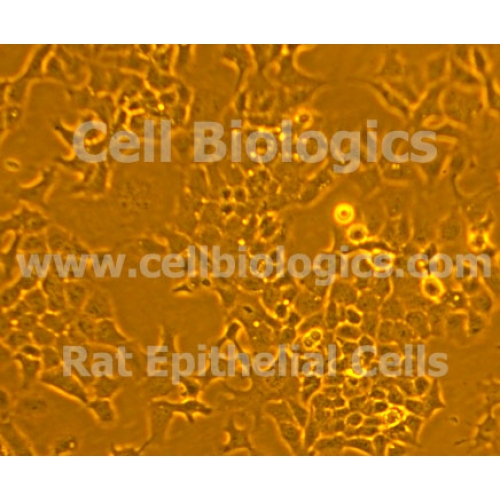 ZDF Rat Diabetic Colonic Epithelial Cells